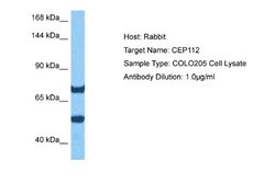 CCDC46 Rabbit anti-Human, Polyclonal, Novus Biologicals 0.1ml; Unconjugated:Antibodies,
